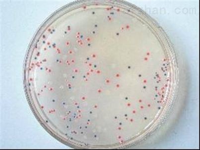 科學家發現可以降解塑料的假單胞菌 未來有可能生產生物塑料